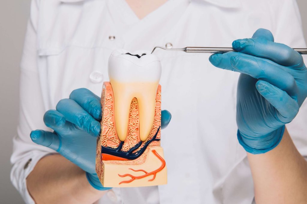 Dentist showing tooth model
